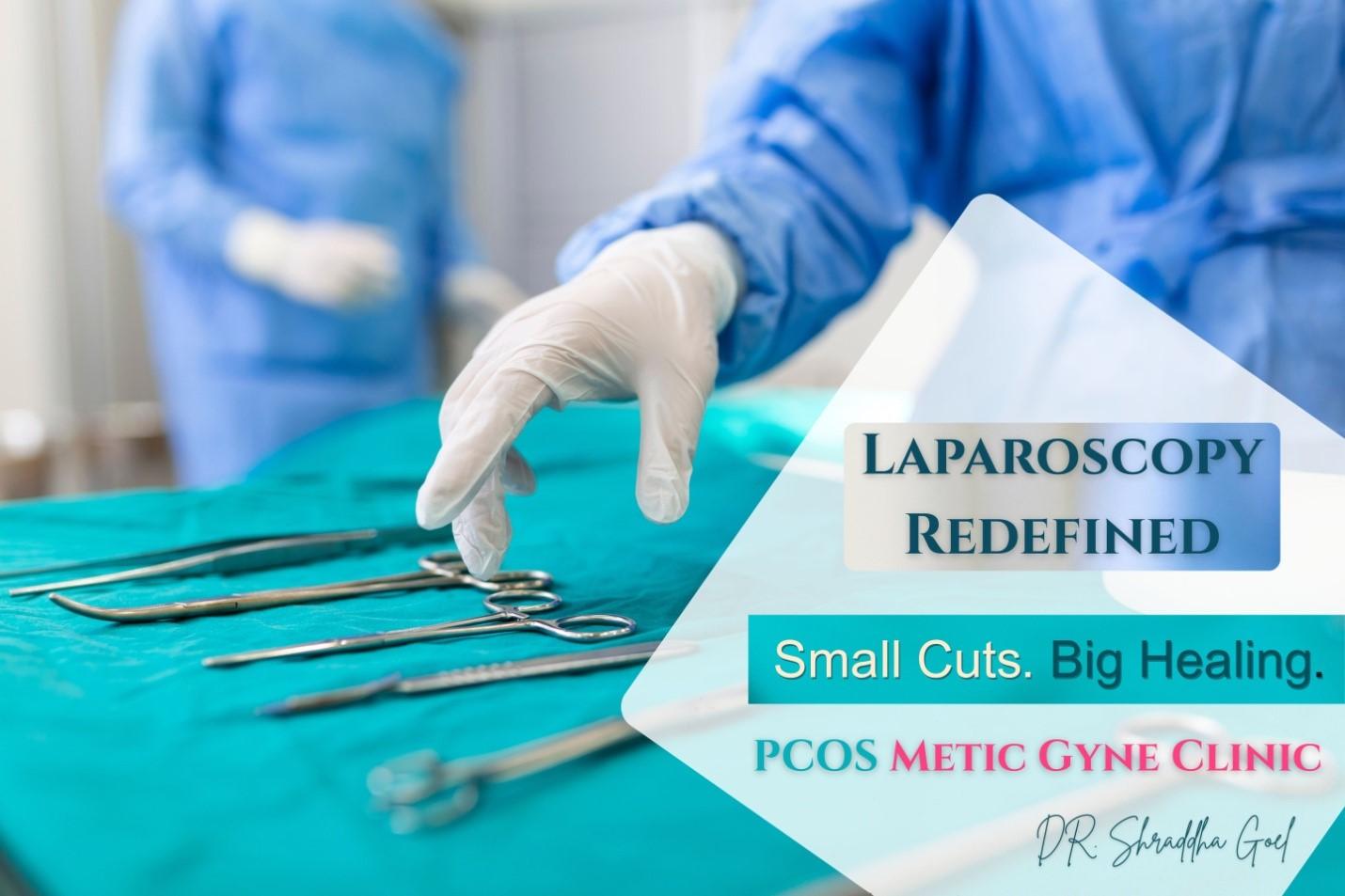 Laparoscopic Endometriosis Treatment in Pune – Advanced Pain Relief & Fertility Care